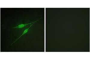 Immunofluorescence analysis of NIH-3T3 cells, using p38 MAPK (Ab-322) Antibody.