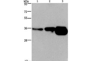 Western Blot analysis of Human breast infiltRative duct and fetal brain tissue, Mouse brain tissue using CUEDC2 Polyclonal Antibody at dilution of 1:600 (CUEDC2 抗体)