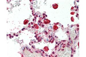 Human Lung, Macrophages: Formalin-Fixed, Paraffin-Embedded (FFPE) (CAPG 抗体)
