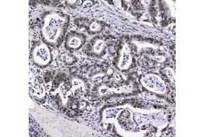 Immunohistochemistry (IHC) image for anti-Apurinic/Apyrimidinic Endonuclease 1 (APEX1) (AA 2-318) antibody (ABIN5692978)