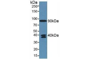 Detection of C4a in Human Serum using Polyclonal Antibody to Complement Component 4a (C4a) (C4A 抗体  (AA 680-756))