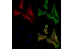 ABIN7093109 and ABIN7097600 staining  cells by IF/ICC.