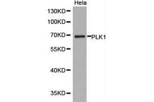 Western Blotting (WB) image for anti-Polo-Like Kinase 1 (PLK1) antibody (ABIN1874166) (PLK1 抗体)