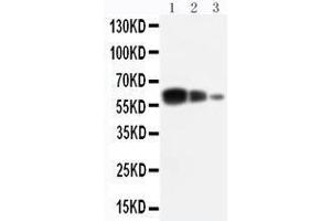 Anti-ADAM10 antibody, Western blotting Lane 1: Recombinant Human ADAM10 Protein 10ng Lane 2: Recombinant Human ADAM10 Protein 5ng Lane 3: Recombinant Human ADAM10 Protein 2. (ADAM10 抗体  (C-Term))