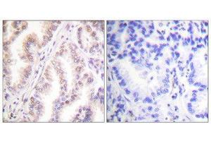 Immunohistochemistry (IHC) image for anti-Protein Inhibitor of Activated STAT, 1 (PIAS1) (N-Term) antibody (ABIN1848832) (PIAS1 抗体  (N-Term))