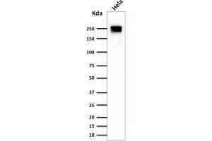 Western Blotting (WB) image for anti-Spectrin, Beta, Non-erythrocytic 2 (SPTBN2) (AA 356-475) antibody (ABIN6940653)