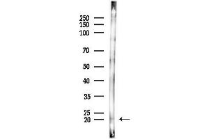 anti-NADH Dehydrogenase (Ubiquinone) 1 beta Subcomplex, 11, 17.3kDa (NDUFB11) (N-Term) antibody