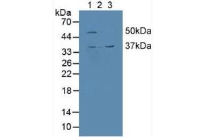 Figure. (CALU 抗体  (AA 20-315))