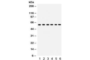 Western blot testing of 1) rat thymus, 2) rat lung, 3) HeLa, 4) 22RV1, 5) A431 and 6) mouse HEPA lysate with CYP24A1 antibody. (CYP24A1 抗体  (AA 153-514))