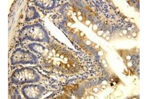 CCR6 Polyclonal Antibody (CCR6 抗体  (N-Term))