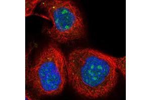 Immunofluorescent staining of human cell line A-431 with SOX7 polyclonal antibody  at 1-4 ug/mL shows positivity in nucleus, nucleoli and vesicles. (PINX1 抗体)