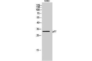 Western Blotting (WB) image for anti-P57 (Ser238) antibody (ABIN3176740) (P57 (Ser238) 抗体)