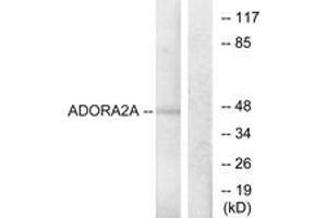 Western blot analysis of extracts from HepG2 cells, using ADORA2A Antibody. (Adenosine A2a Receptor 抗体  (AA 321-370))