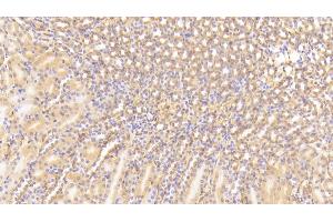 Detection of C3a in Mouse Kidney Tissue using Polyclonal Antibody to Complement Component 3a (C3a) (C3a 抗体  (AA 671-748))