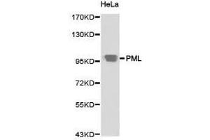 Western Blotting (WB) image for anti-Promyelocytic Leukemia (PML) antibody (ABIN1874171) (PML 抗体)