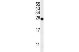 Western blot analysis of SPR antibody and mouse liver tissue lysate. (SPR 抗体  (AA 231-260))