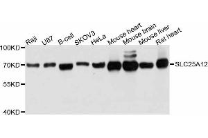 Western blot analysis of extracts of various cell lines, using SLC25A12 antibody. (SLC25A12 抗体  (AA 1-180))