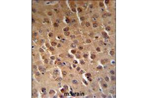 PFTK1 Antibody (N-term P82) (RB18842) IHC analysis in formalin fixed and paraffin embedded human brain tissue followed by peroxidase conjugation of the secondary antibody and DAB staining.