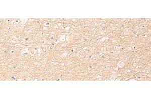 Immunohistochemistry of paraffin-embedded Human brain tissue using ELP1 Polyclonal Antibody at dilution of 1:30(x200) (IKAP/p150 抗体)