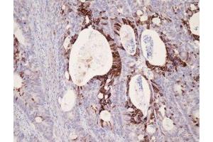 Immunohistochemistry (IHC) image for anti-Keratin 25 (KRT25) (C-Term) antibody (ABIN870621) (Keratin 25 抗体  (C-Term))