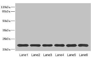 Western blot All lanes: SAR1A antibody at 4. (SAR1A 抗体  (AA 1-198))