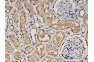 Immunostaining (ISt) image for anti-Copper Chaperone For Superoxide Dismutase (CCS) (AA 175-274) antibody (ABIN523352)