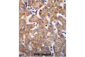 ANKRD58 Antibody (C-term) immunohistochemistry analysis in formalin fixed and paraffin embedded human liver tissue followed by peroxidase conjugation of the secondary antibody and DAB staining. (ANKRD58 抗体  (C-Term))