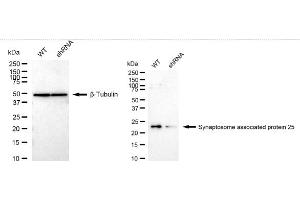 Western blotting analysis using Synaptosome associated protein 25 antibody (ABIN7800487). (Recombinant SNAP25 抗体)
