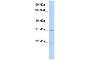 Western Blotting (WB) image for anti-Solute Carrier Family 25 (Mitochondrial Oxodicarboxylate Carrier), Member 21 (Slc25a21) (N-Term) antibody (ABIN2781689)