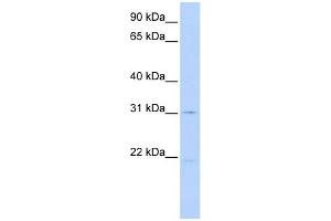 WB Suggested Anti-SLC25A21 Antibody Titration:  0.