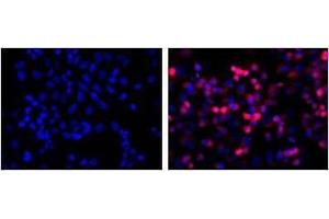 LEFT: untransfected control, RIGHT: anti-His (in red) on His-tagged fusion proteins in HEK293 cells. (His Tag 抗体)