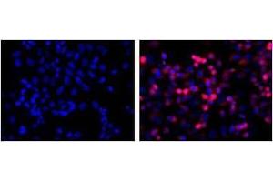 LEFT: untransfected control, RIGHT: anti-His (in red) on His-tagged fusion proteins in HEK293 cells. (His Tag 抗体)