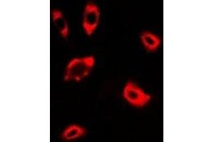 Immunofluorescent analysis of DPP8 staining in A549 cells. (DPP8 抗体)