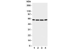 Western blot testing of P2X6 antibody and Lane 1:  U87;  2: 22RV1;  3: Jurkat;  4: HT1080 cell lysate. (P2RX6 抗体  (C-Term))