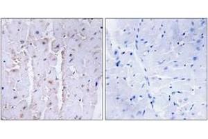 Immunohistochemistry analysis of paraffin-embedded human heart tissue, using AKAP13 Antibody. (AKAP13 抗体  (AA 721-770))