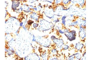 Formalin-fixed, paraffin-embedded human Placenta stained with Transglutaminase II Mouse Monoclonal Antibody (SPM358). (Transglutaminase 2 抗体)