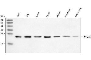 Western blot analysis of RPS5 using anti-RPS5 antibody (ABIN7599076).