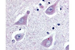 Anti-GPR30 antibody IHC of human brain, hippocampus. (GPER 抗体  (Extracellular Domain))