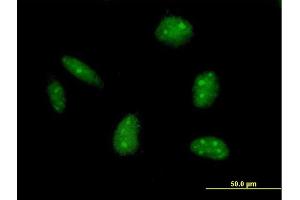 Immunofluorescence of purified MaxPab antibody to EXO1 on HeLa cell. (Exonuclease 1 抗体  (AA 1-846))