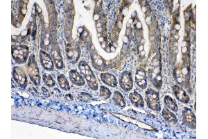 IHC analysis of CD151 using anti- CD151 antibody .
