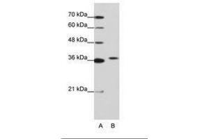 Image no. 1 for anti-Exosome Component 7 (EXOSC7) (AA 71-120) antibody (ABIN202173) (EXOSC7 抗体  (AA 71-120))