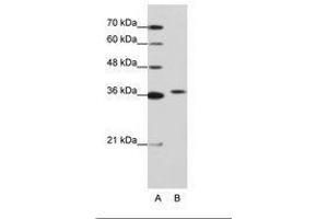 Image no. 1 for anti-Exosome Component 7 (EXOSC7) (AA 71-120) antibody (ABIN202173) (EXOSC7 抗体  (AA 71-120))