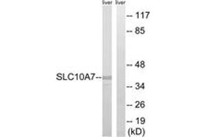 Western blot analysis of extracts from mouse liver cells, using SLC10A7 Antibody. (SLC10A7 抗体  (AA 168-217))