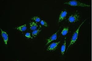IF analysis of C1QBP using anti-C1QBP antibody (ABIN4886491). (C1QBP 抗体  (AA 190-282))