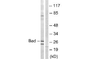 Immunohistochemistry analysis of paraffin-embedded human brain tissue using BAD (Ab-134) antibody. (BAD 抗体)