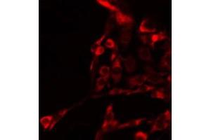 ABIN6278063 staining HepG2 by IF/ICC. (GRIA4 抗体)