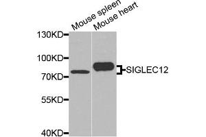 Western blot analysis of extracts of mouse spleen and mouse heart cells, using SIGLEC12 antibody. (SIGLEC12 抗体)