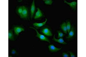 Immunofluorescent analysis of A549 cells using ABIN7146698 at dilution of 1:100 and Alexa Fluor 488-congugated AffiniPure Goat Anti-Rabbit IgG(H+L) (CA1 抗体  (AA 2-261))
