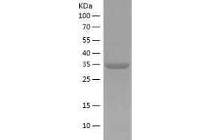 ELF1 Protein (AA 366-412) (His tag)