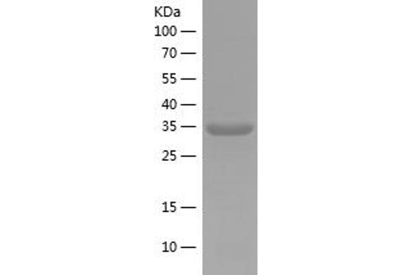 ELF1 Protein (AA 366-412) (His tag)